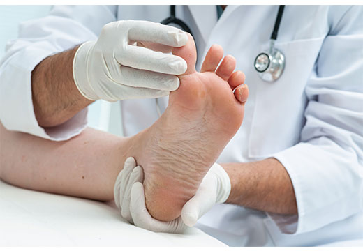 диагностика наростов на ноге
