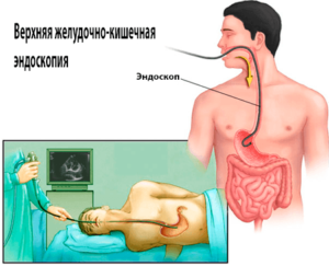 Эндоскопия желудка у взрослого человека