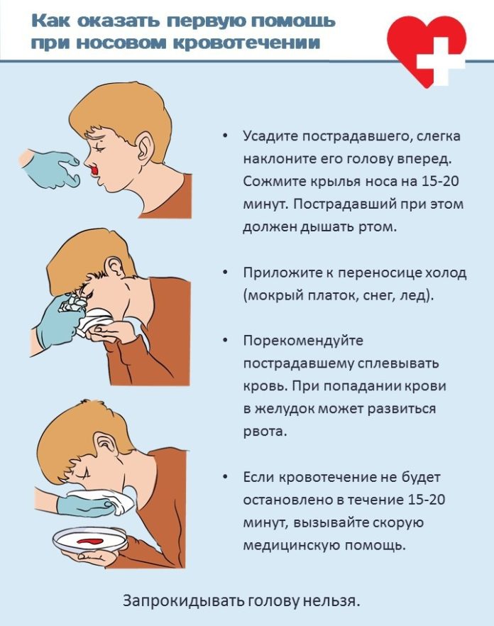 Как остановить кровь с носа
