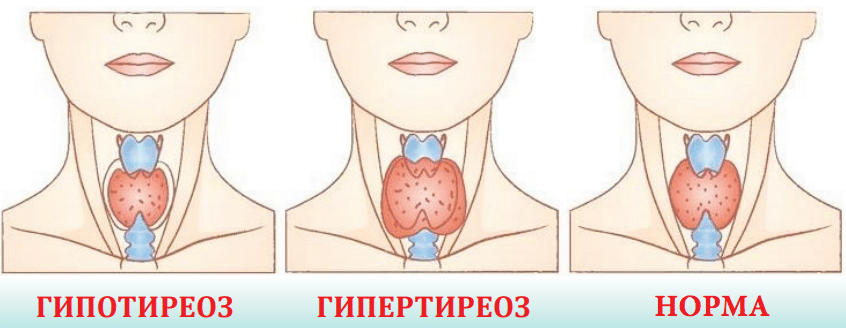 Норма щитовидной железы