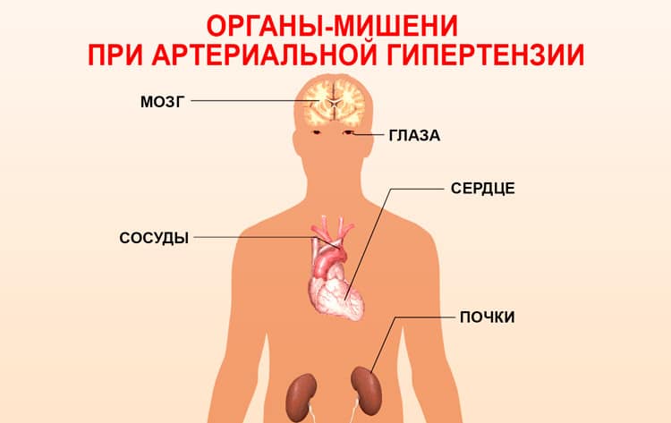 Органы мишени при гипертонии