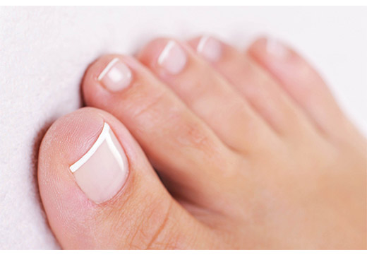 Бородавки между пальцами ног: способы лечения и удаления | vrednuga